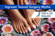Perth Ingrown Toenail Surgery: Myths vs. Facts