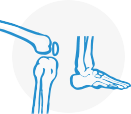 Heel Pain Treatment