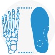 Custom Orthotic